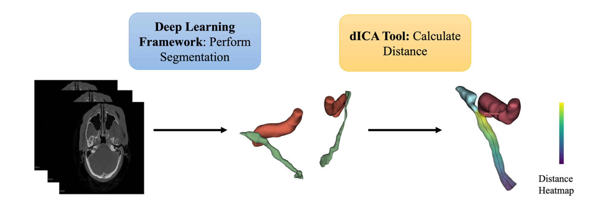 Overview of method